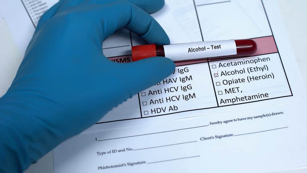 Image is of a blood sample labeled for alcohol testing on medical documentation, concept of a felony DUI lawyer examining chemical test evidence in a DUI case.
