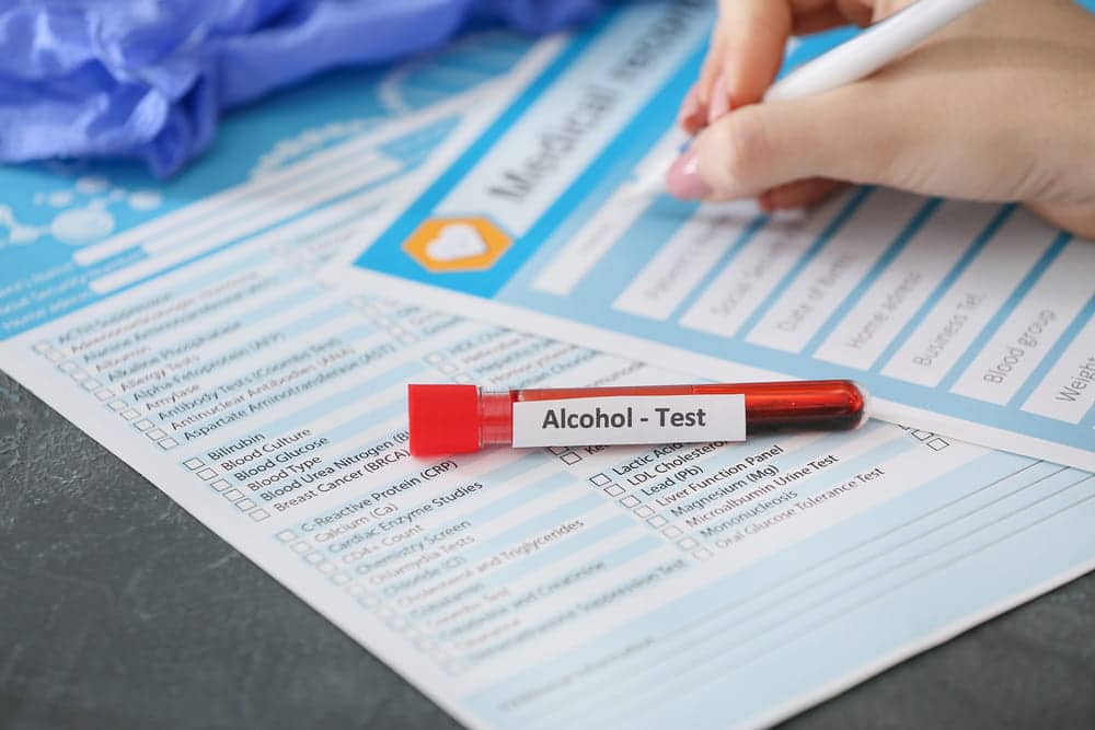Image is of an alcohol test sample and medical paperwork, concept of evidence that an Aiken probation violation lawyer may review during a probation violation case.