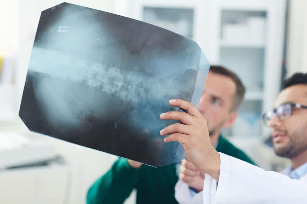 Image is of medical professionals examining a spinal X-ray, concept of an Aiken spinal cord injury lawyer evaluating evidence related to serious spinal injuries.